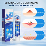 Wart Remover - Crema Removedora De Verrugas